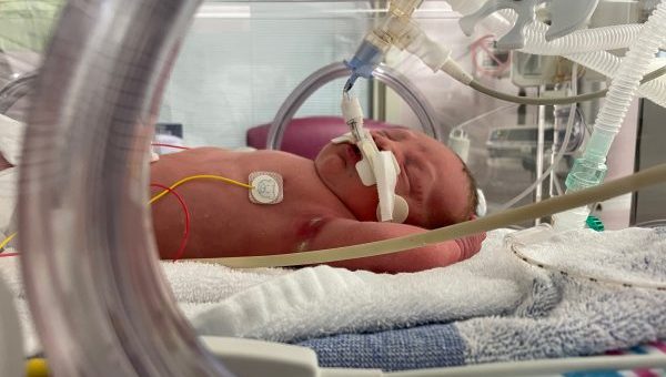 My son was born six weeks premature, but Chestnut House became the perfect base